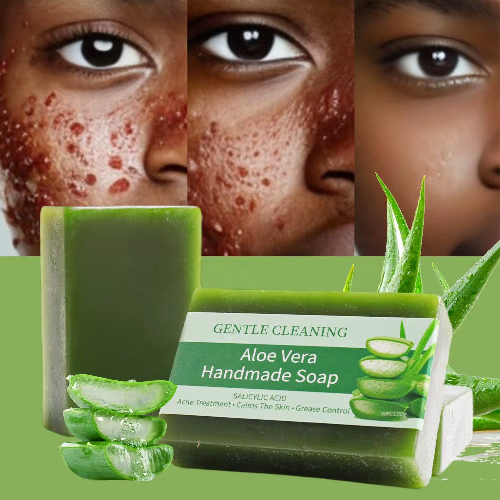 Flawless Royal Glow Aloe Vera Effective Acne Removal Facial & Body Deep Cleansing Cool Fresh Aloe Vera Soap
